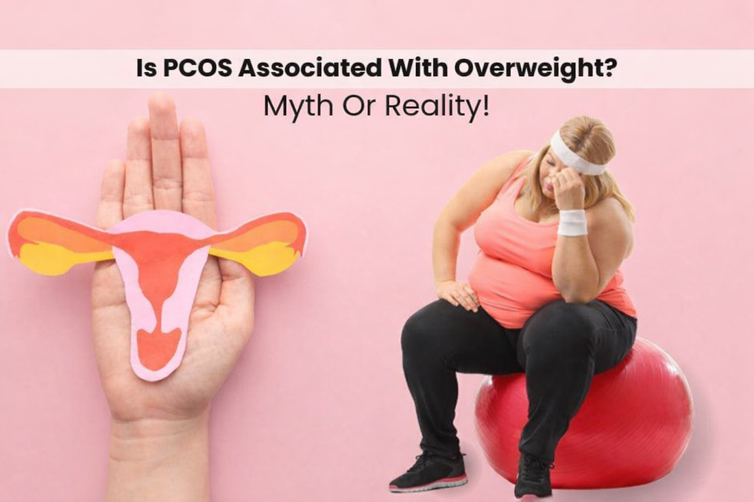 Obesity and PCOS: Understanding the Strong Metabolic Connection