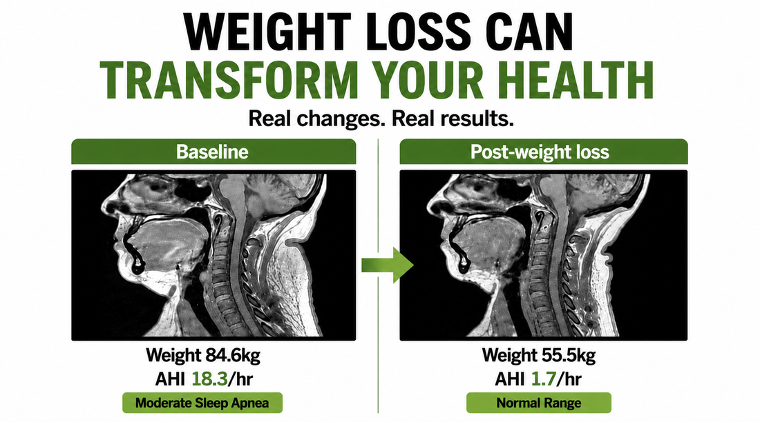 Weight Loss Can Transform More Than Your Appearance — The Difference Goes Beyond the Mirror
