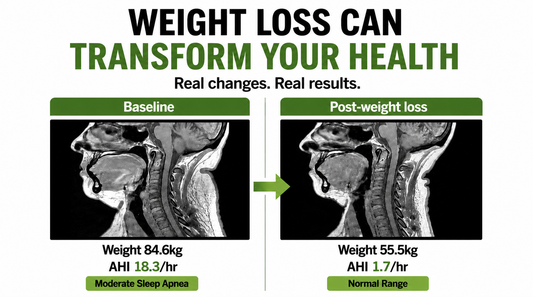 Weight Loss Can Transform More Than Your Appearance — The Difference Goes Beyond the Mirror